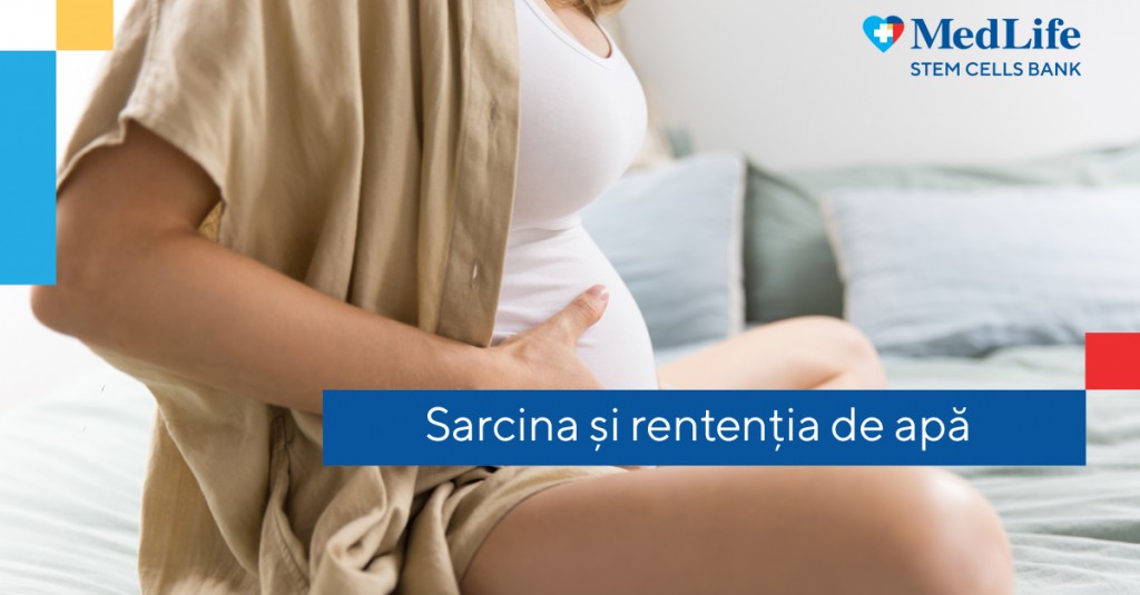 retentia de apa