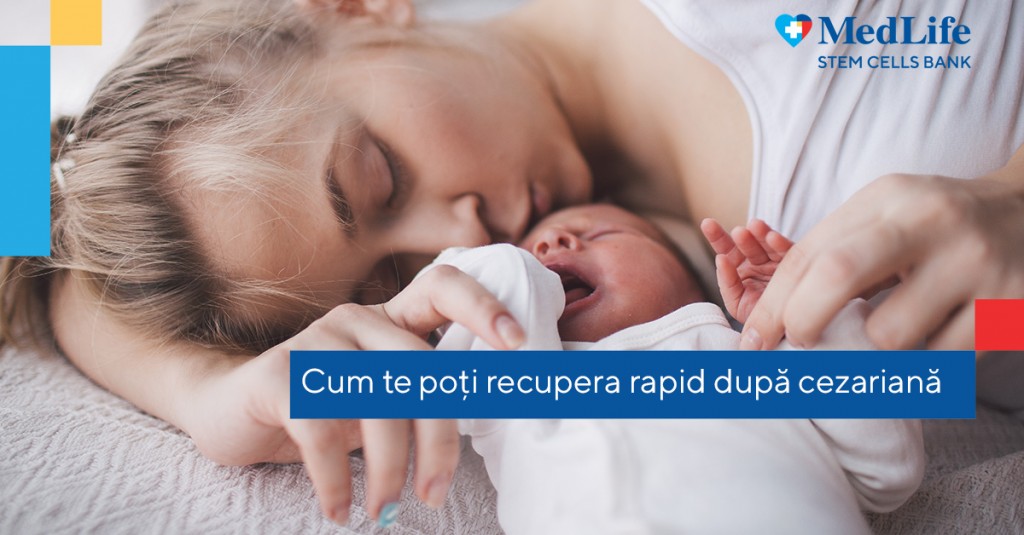 Recuperarea după cezariană cum îți poți reveni cât mai ușor (1)