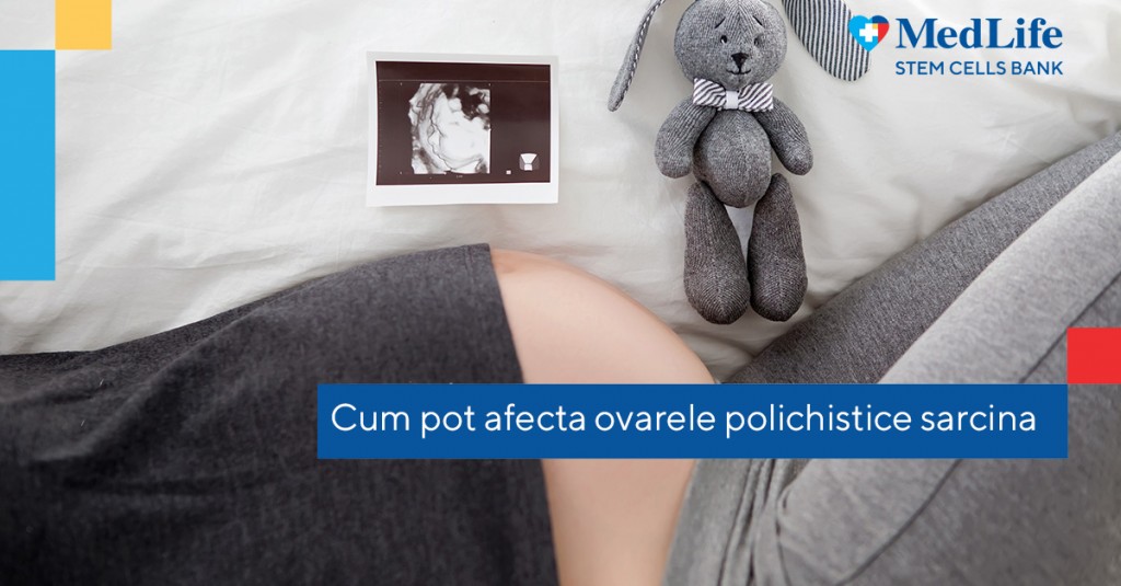 Ovarele polichistice Cum afectează sarcina (1)